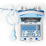 Prime 56X Ultrasound Scanner